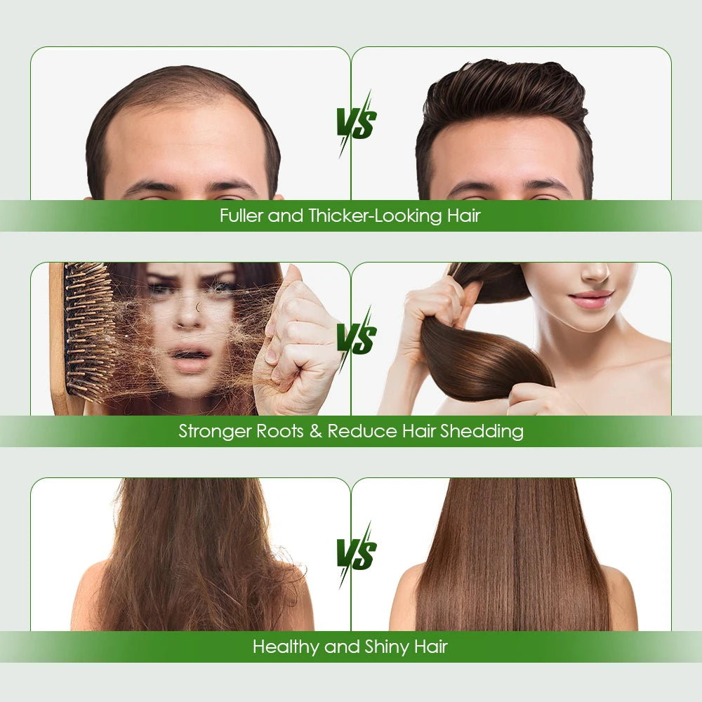 Vabena Anti-Hair Loss Serum & Conditioner for Stronger Roots