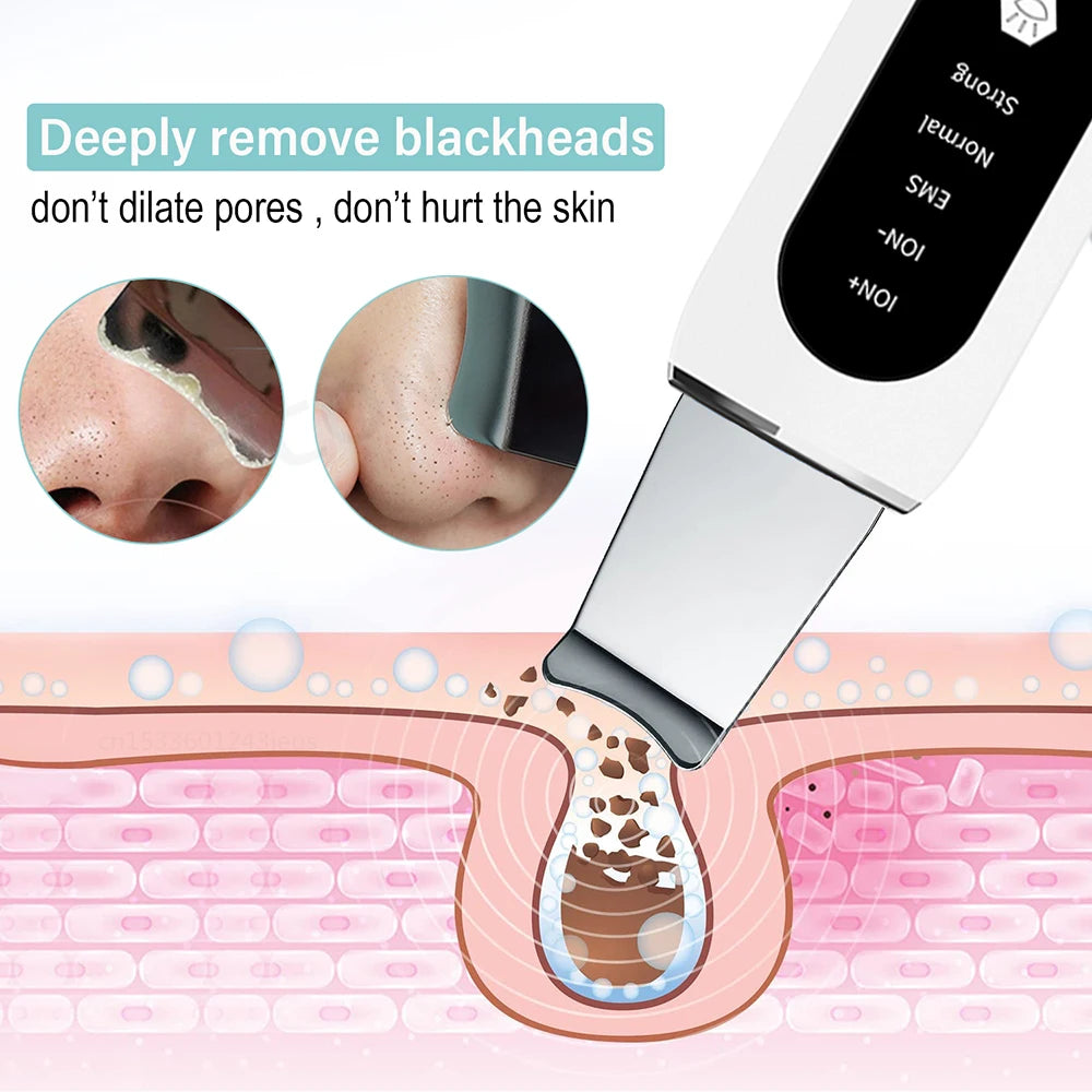 Peicon Professional Ultrasonic Skin Scrubber - Deep Cleansing & Exfoliation