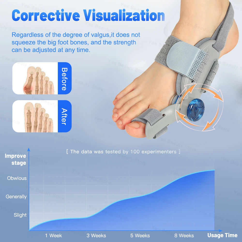 MERALL Adjustable Bunion Corrector | Hallux Valgus Relief & Toe Separator