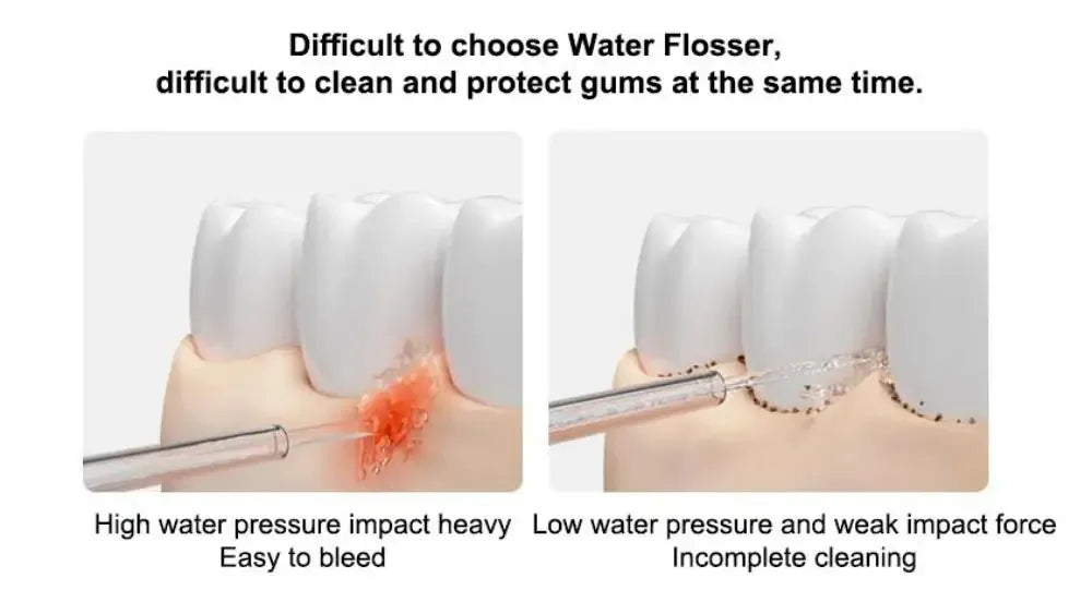MIJIA MEO705 Portable Oral Irrigator for Dental Whitening
