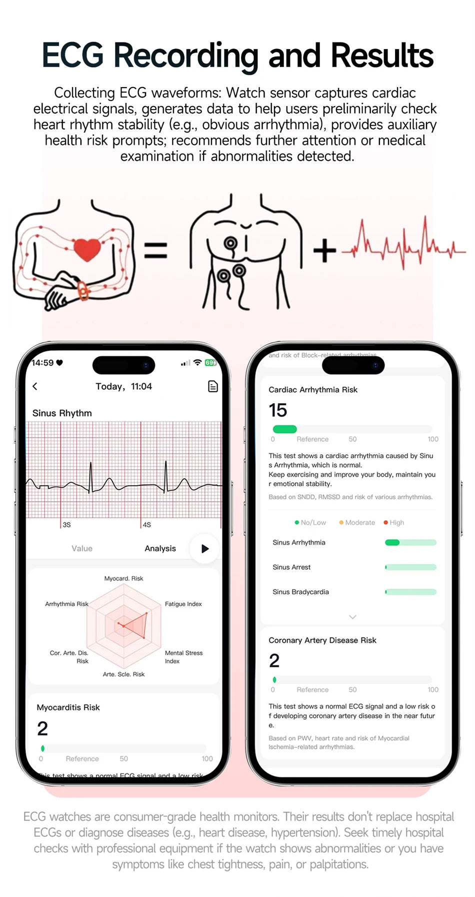 Vabena Men's ECG Smartwatch: Accurate Health Diagnosis with Blood Pressure, Oxygen, Fat, Uric Acid & Temp Monitoring