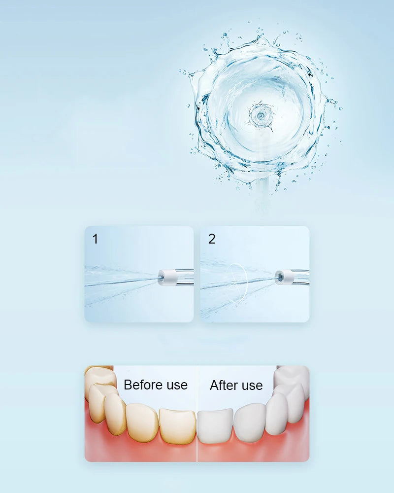 MIJIA XIAOMI F300 Portable Water Flosser - Deep Clean Oral Irrigator