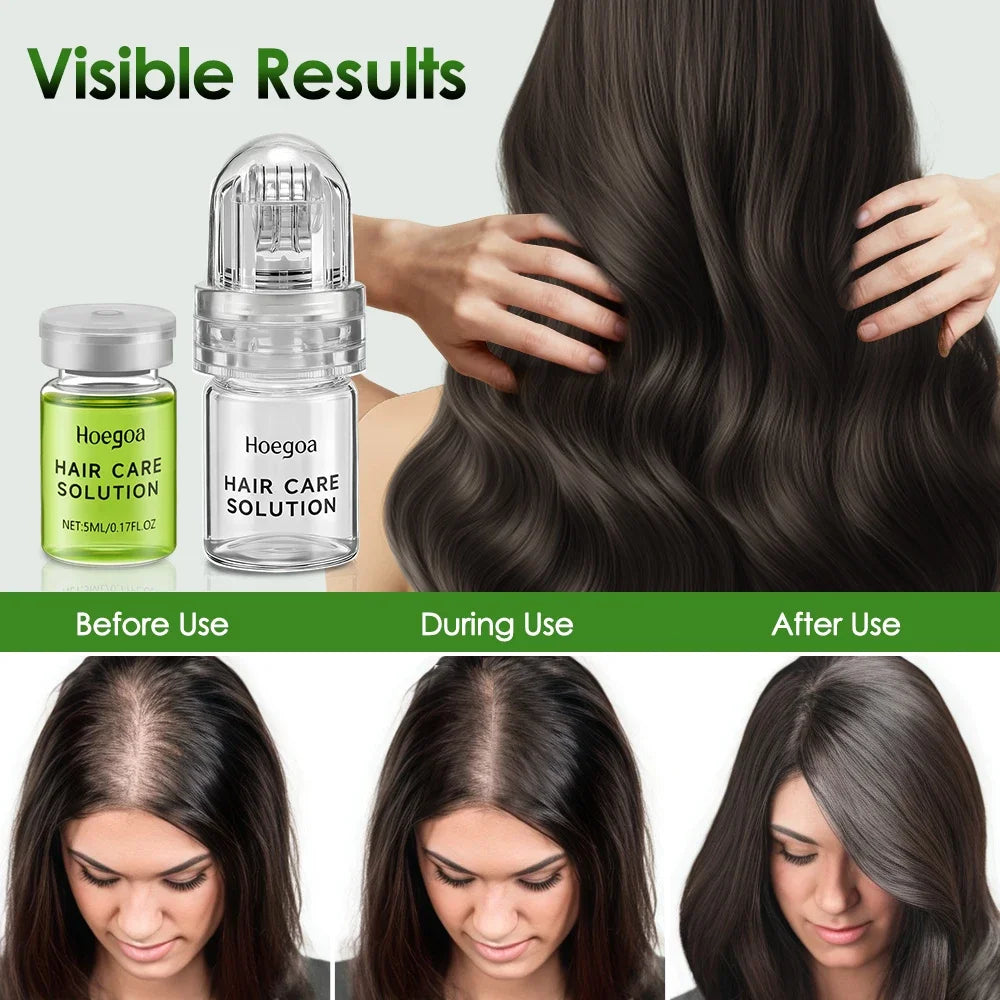 Vabena Anti-Hair Loss Serum & Conditioner for Stronger Roots