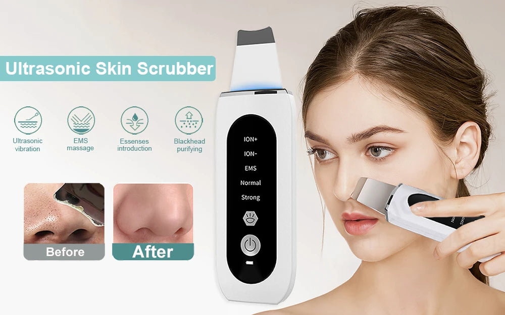 Peicon Professional Ultrasonic Skin Scrubber - Deep Cleansing & Exfoliation