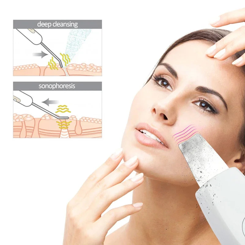 Vabena Deep Facial Pore Cleaner & Massager - Clear Skin Device