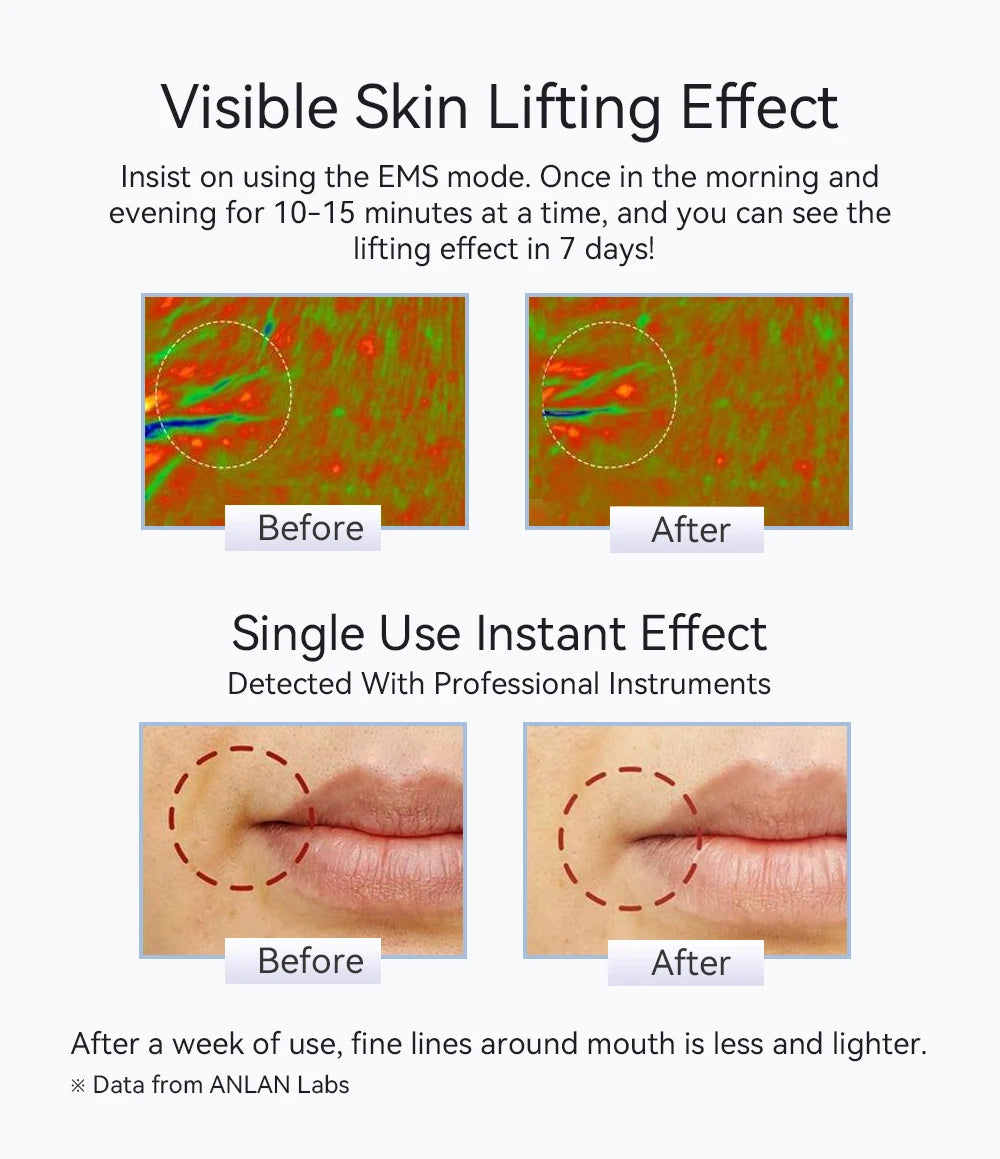 ANLAN Facial Massager Pro | Microcurrent Face Lifting & Anti-aging Device