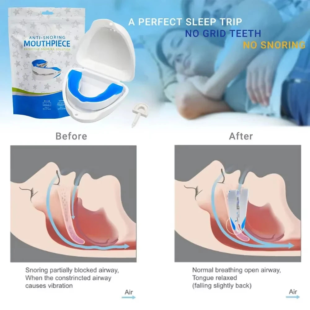 Silicone Anti-Snore Mouthpiece - Bruxism & Apnea Relief