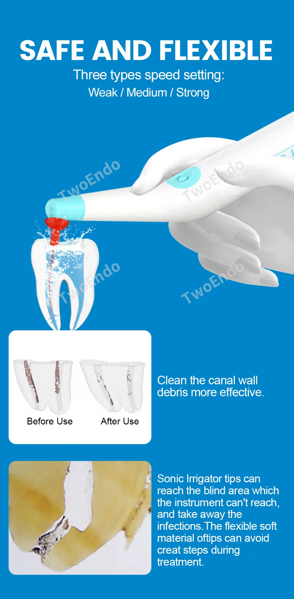 60Pcs Dental Sonic Irrigator Tips for Root Canal Cleaning & Endodontic Tools