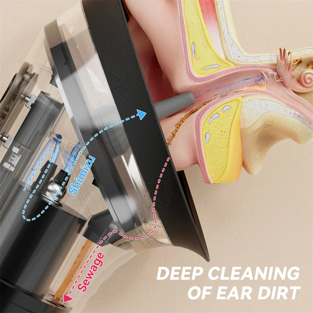 Electric Ear Wax Removal System - Water Powered Ear Cleaner with 3 Pressure Settings