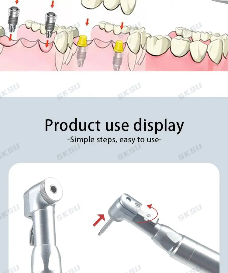 Dental Implant Universal Torque Wrench Screwdriver Kit - Prosthetic Repair Tools