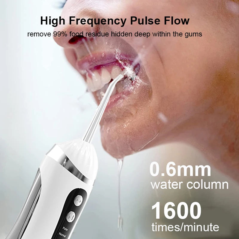 Vabena Electric Oral Irrigator - 3 Modes, USB Rechargeable for Superior Dental Care