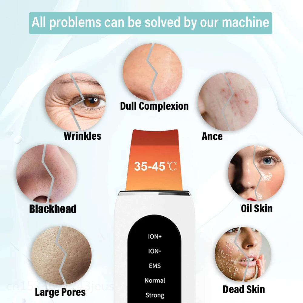 Peicon Professional Ultrasonic Skin Scrubber - Deep Cleansing & Exfoliation