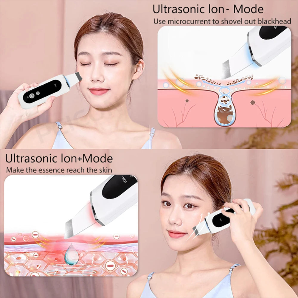 Peicon Professional Ultrasonic Skin Scrubber - Deep Cleansing & Exfoliation
