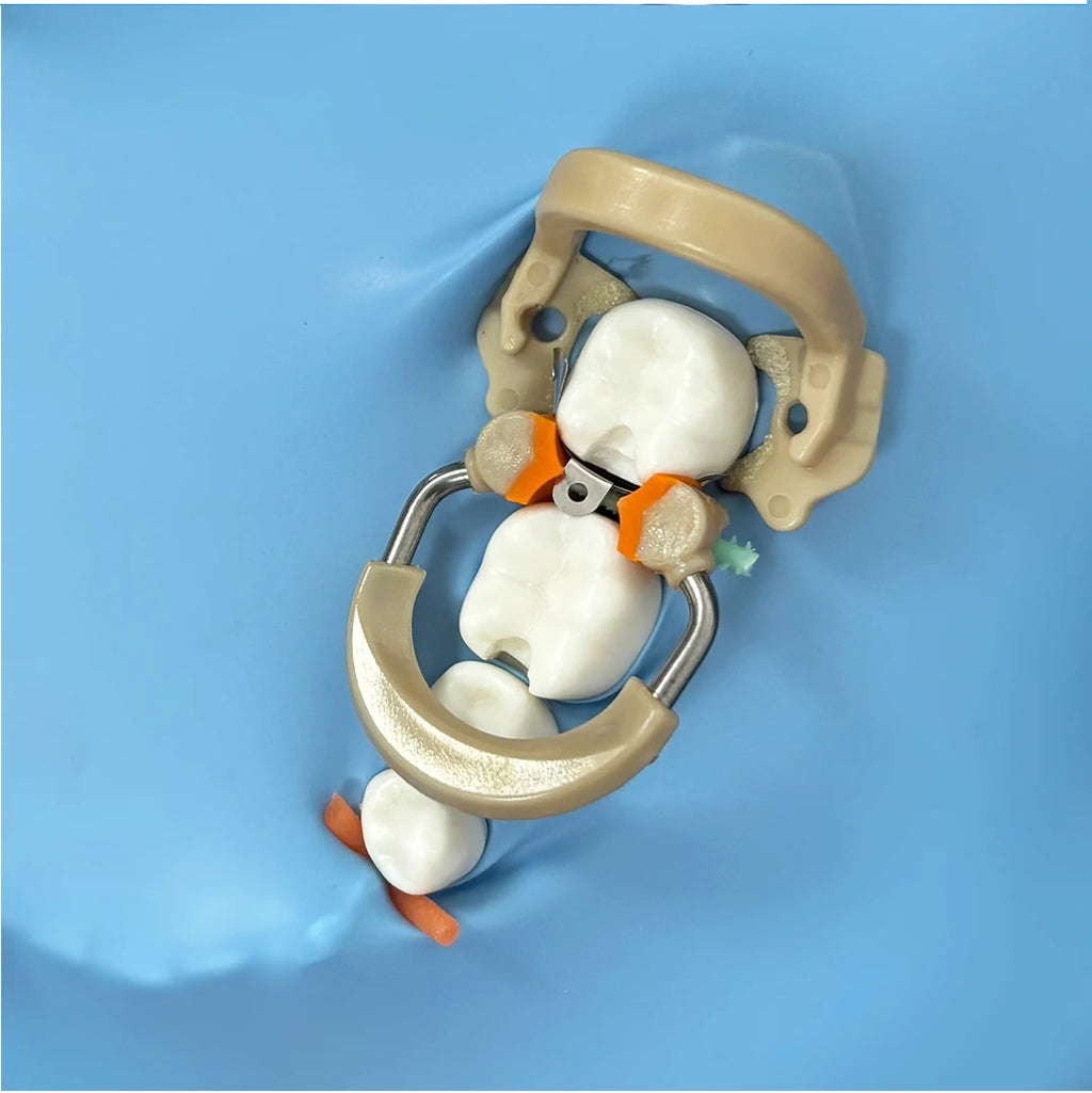 1PC Dental NITI Clamp Ring & Metal Matrices System for Premolar & Molar Restorations
