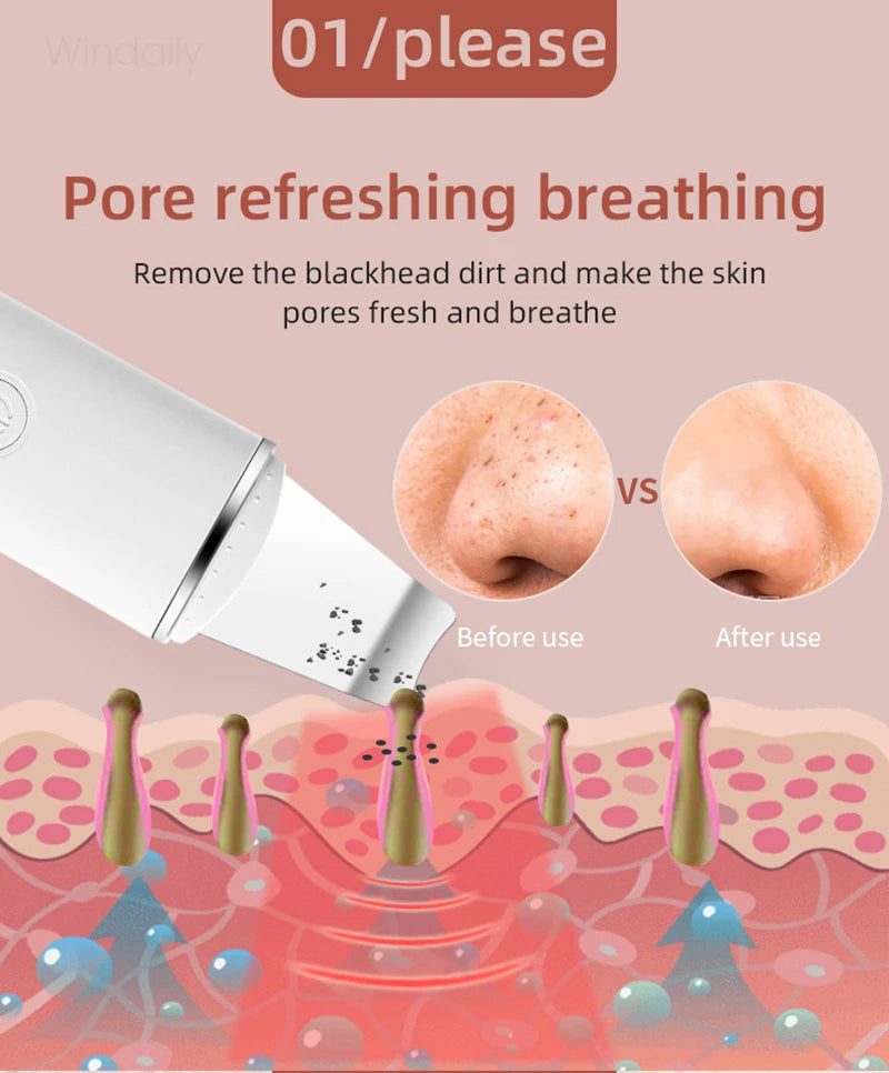 Windaily Advanced Cavitation Face Spatula Scrubber - Deep Cleanse & Rejuvenate