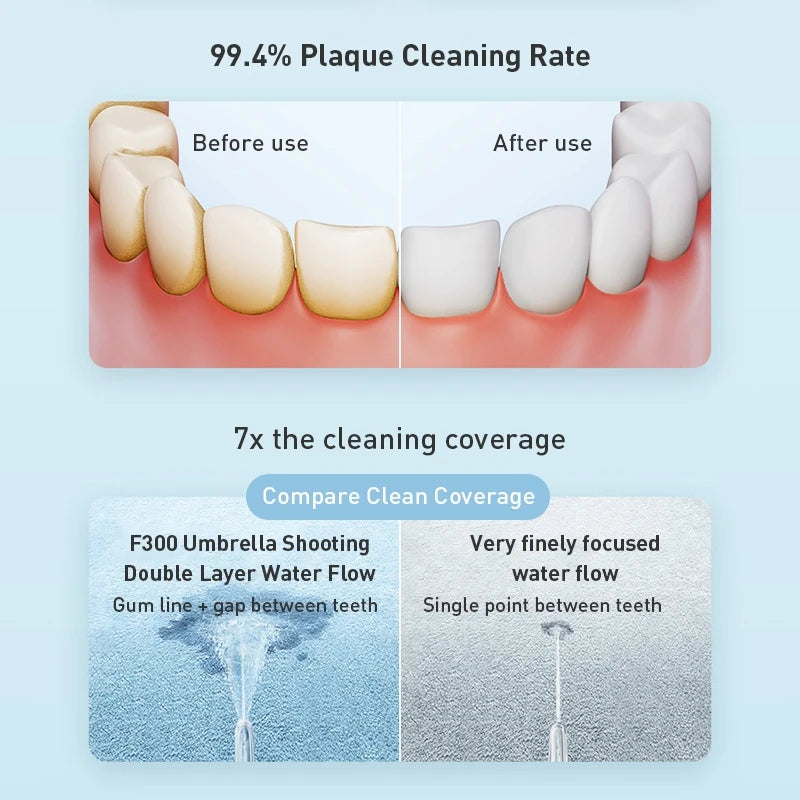 MIJIA XIAOMI F300 Portable Water Flosser - Deep Clean Oral Irrigator