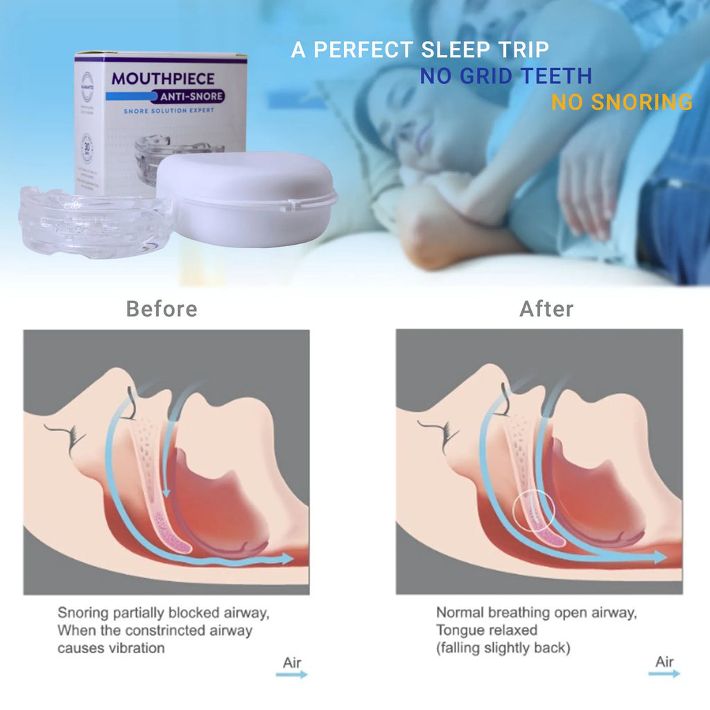 Silicone Anti-Snore Mouthpiece - Bruxism & Apnea Relief