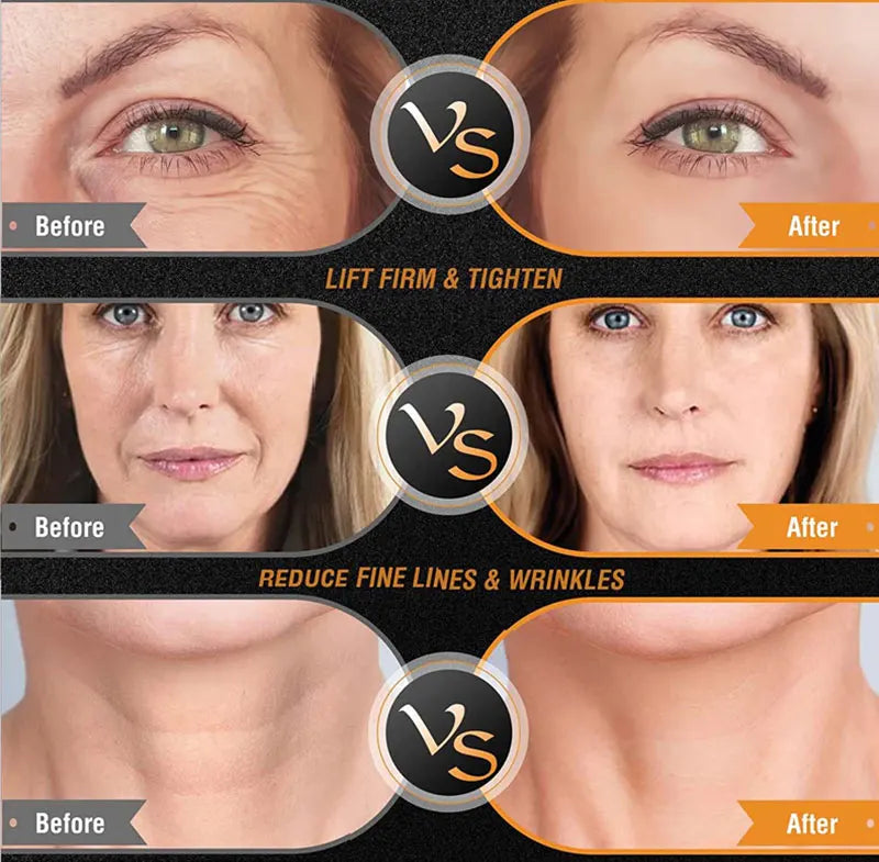 EMS RF Facial Body Machine | Skin Tightening Face Lift & Anti-Aging Device for Home & Pro Use