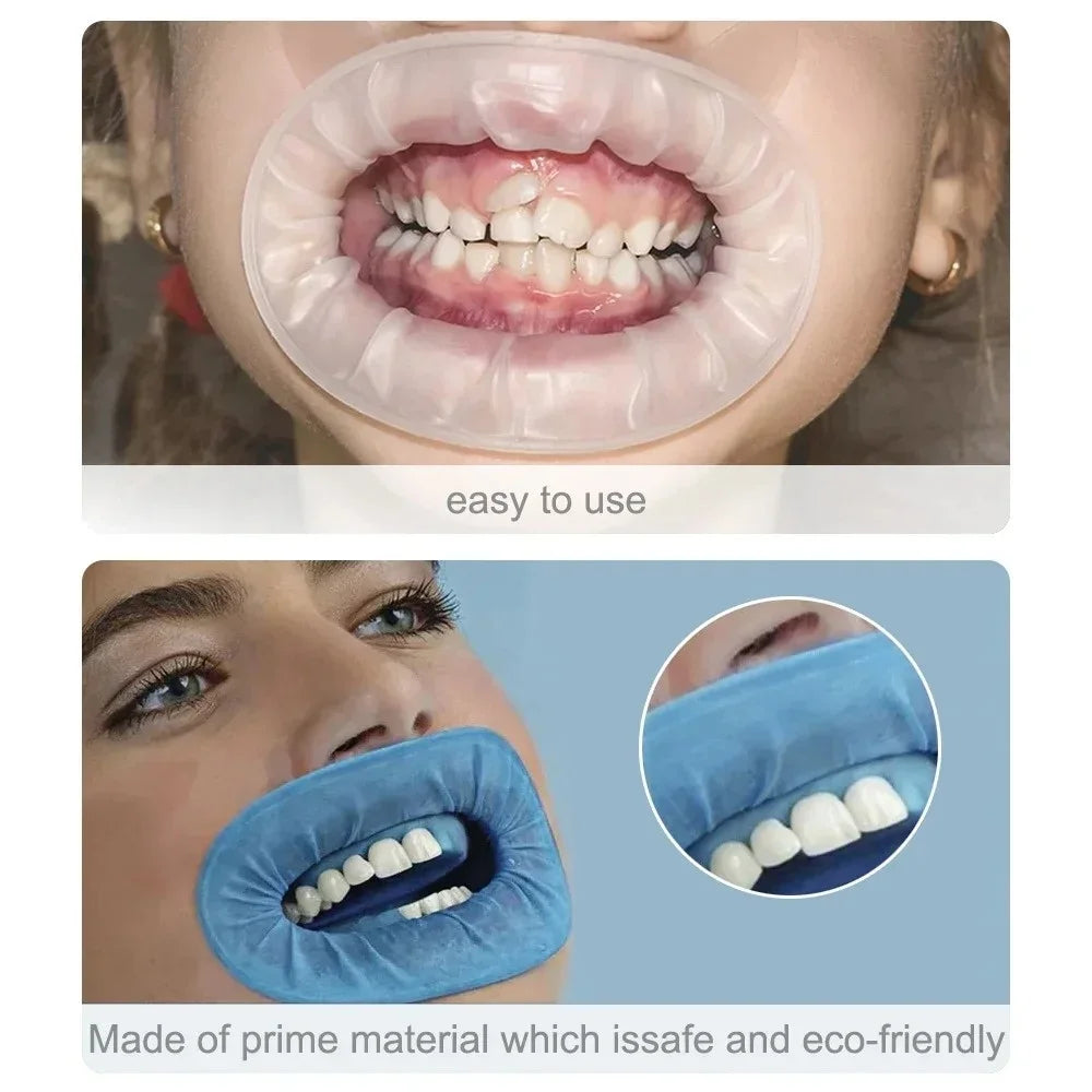 JUMTOP 10Pcs Dental O-Shape Disposable Rubber Dam Mouth Retractors