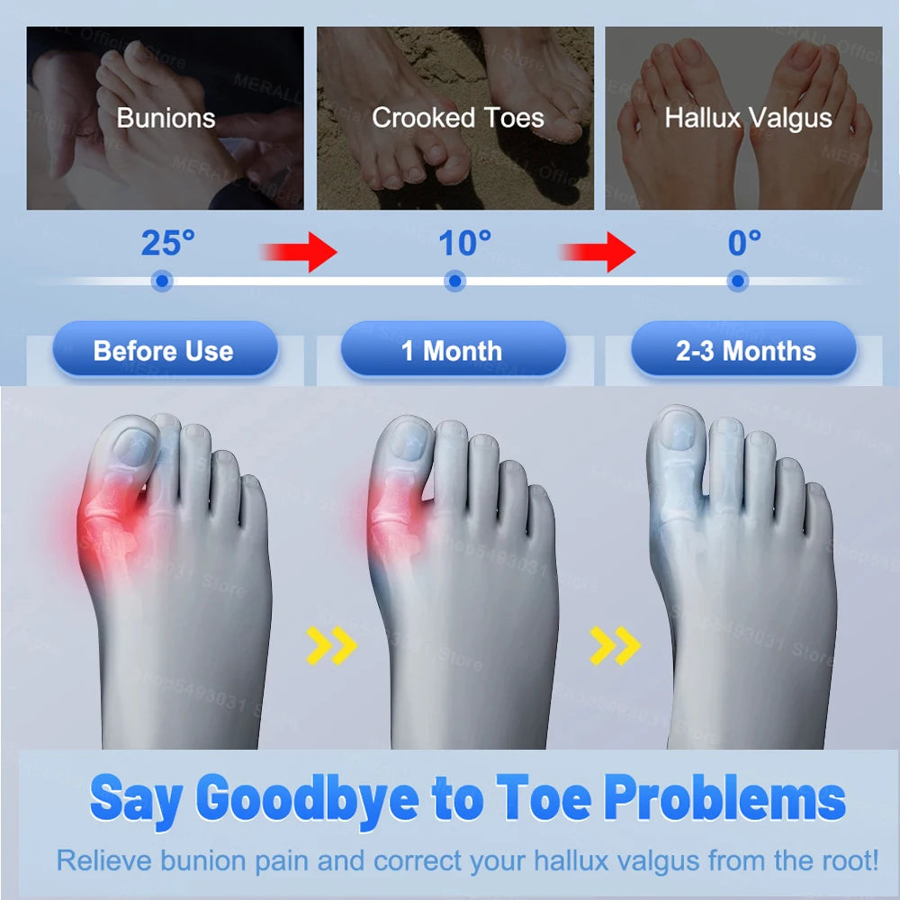 MERALL Adjustable Bunion Corrector | Hallux Valgus Relief & Toe Separator