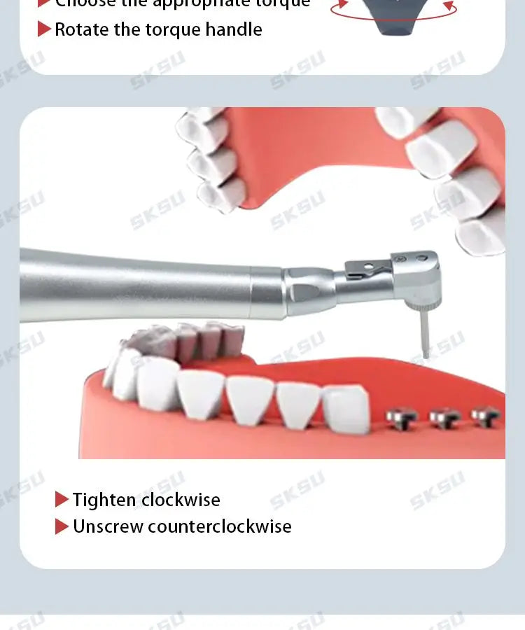 Dental Implant Universal Torque Wrench Screwdriver Kit - Prosthetic Repair Tools