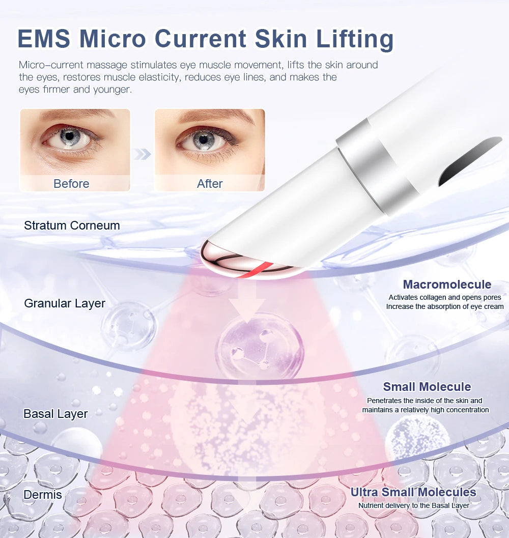 ANLAN Electric Eye Massager | Microcurrent Skin Lifting, Wrinkle & Dark Circle Remover