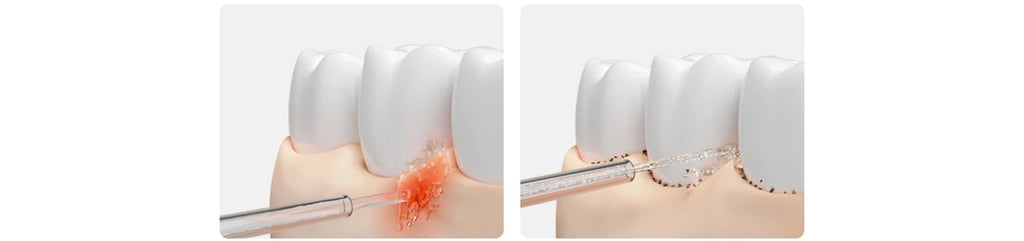 MIJIA Electric Oral Irrigator 2 - Ultrasonic Dental Flosser