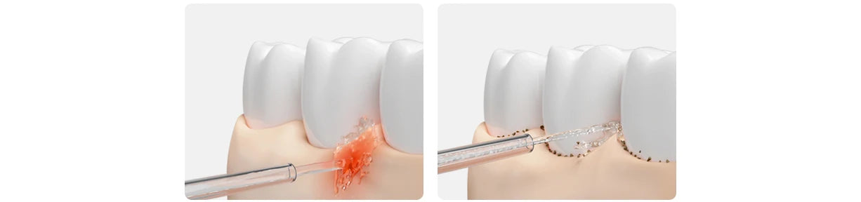 MIJIA Electric Oral Irrigator 2 - Ultrasonic Dental Flosser