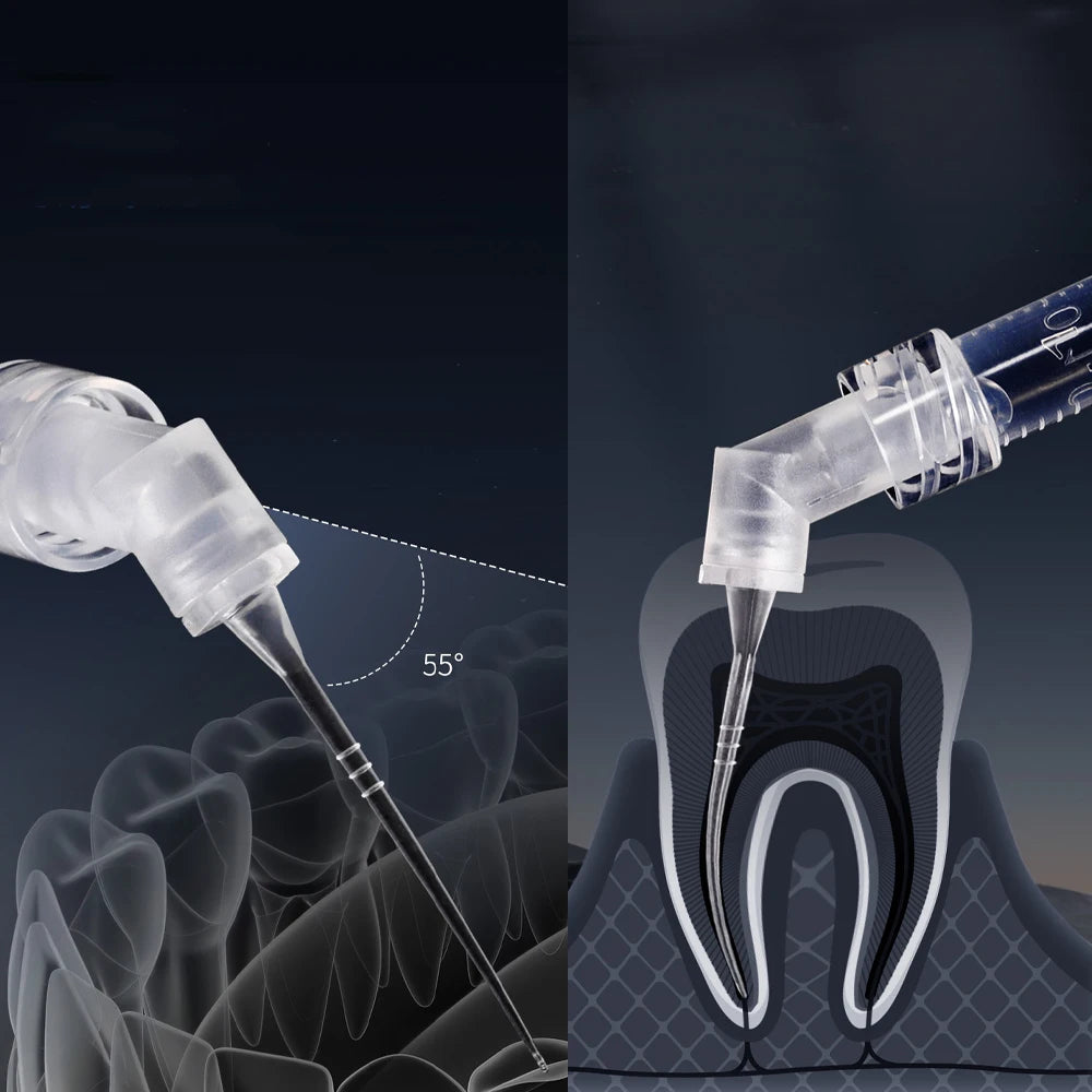 Dental Endo Irrigation Needle Tips 30G 0.3mm - 30 Pack Root Canal Cleaning